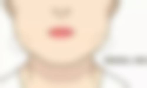 郯城杜文医生技术特点