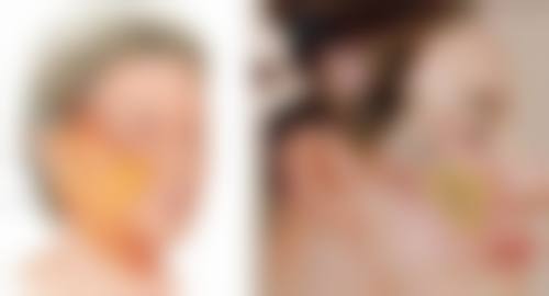 注射隆鼻后肿胀情况怎么样