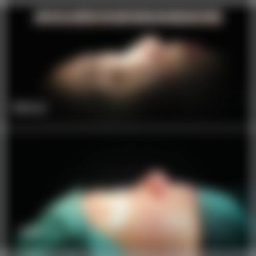 韩国丽倍摞女性私密整形医院擅长项目