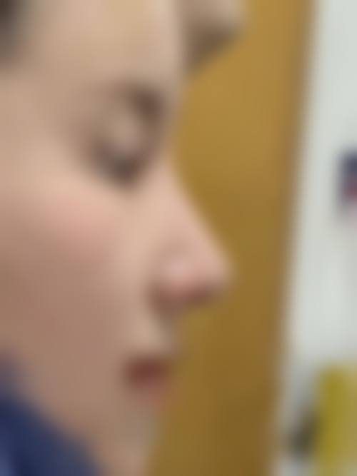 郑州谢保勋医疗美容预约挂号方式：便捷效率高开启变得更美