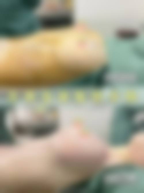 韩国丽倍摞女性私密整形医院口碑怎么样