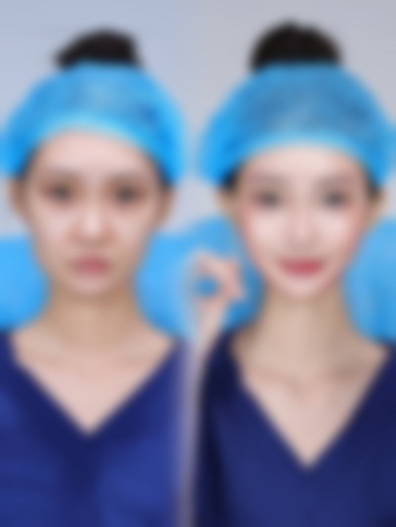 郑州谢保勋医疗美容电话号码：一键开启变得更美之旅