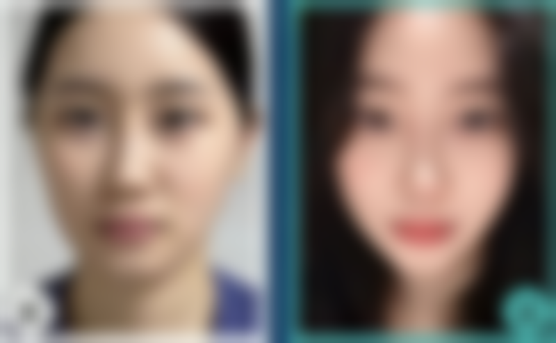 刘思学医生技术特点