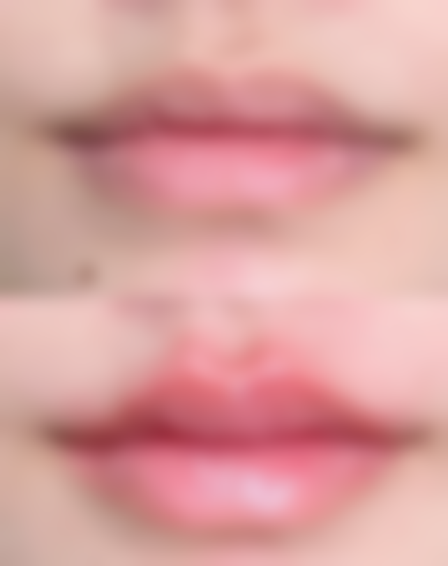 激光祛疤去脸上疤痕适合吗