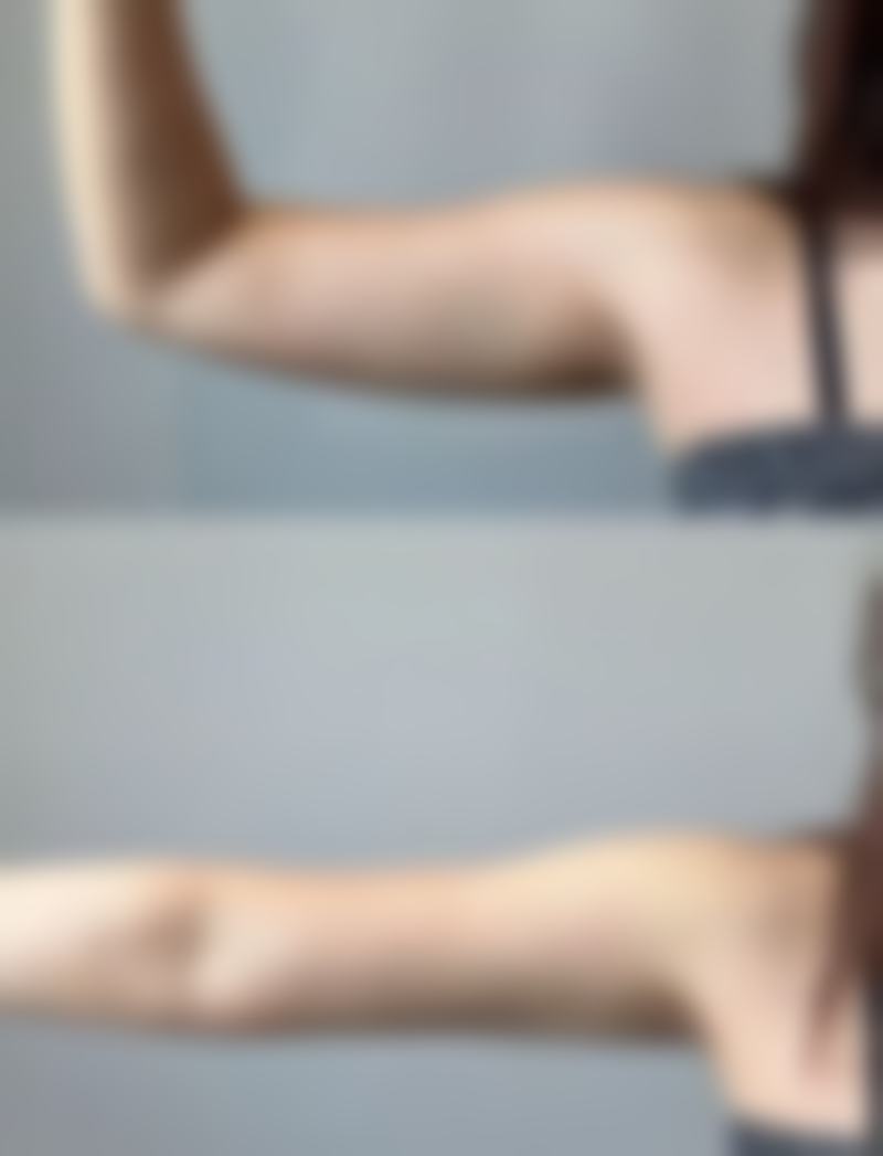 Ahvie Herskowitz看诊优势