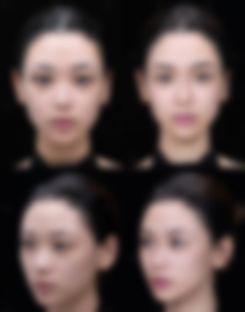 天津博莱美整形美容医院口碑怎么样