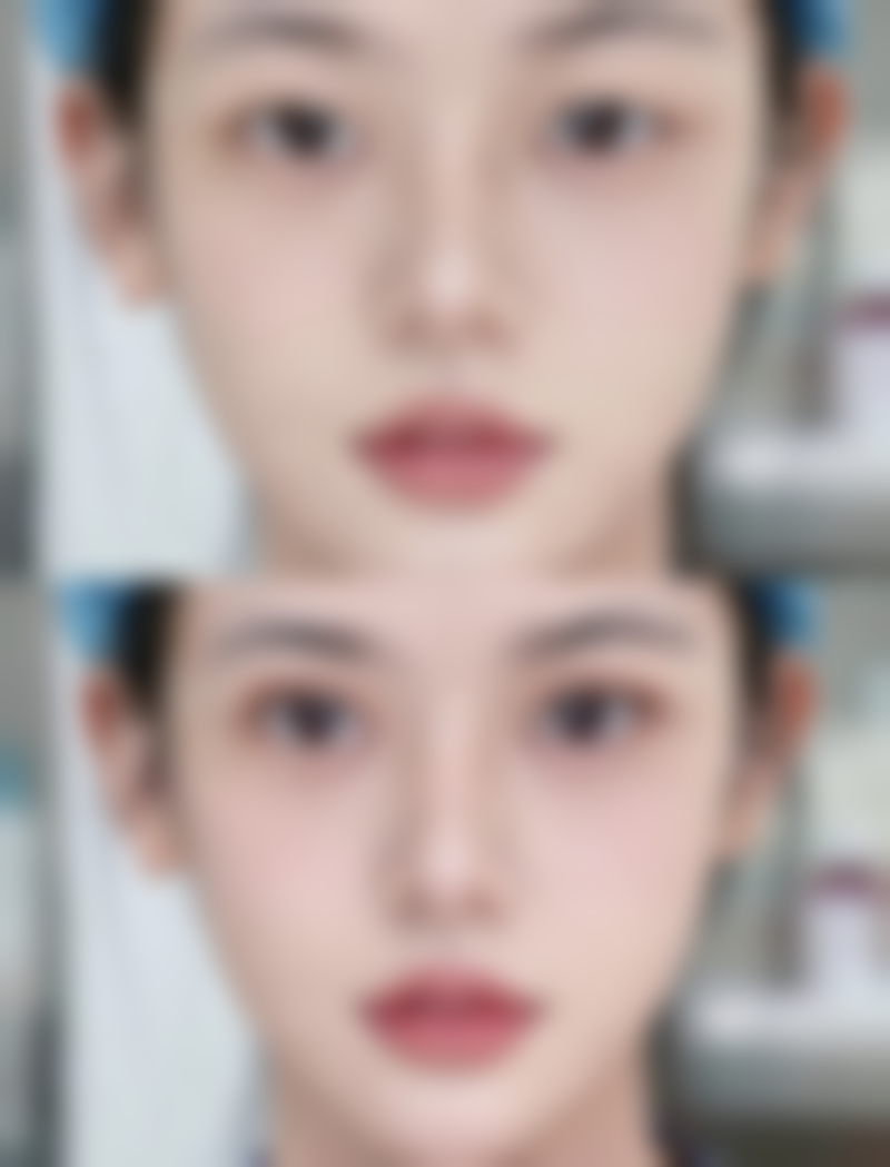 李炳乾院长的看诊优势