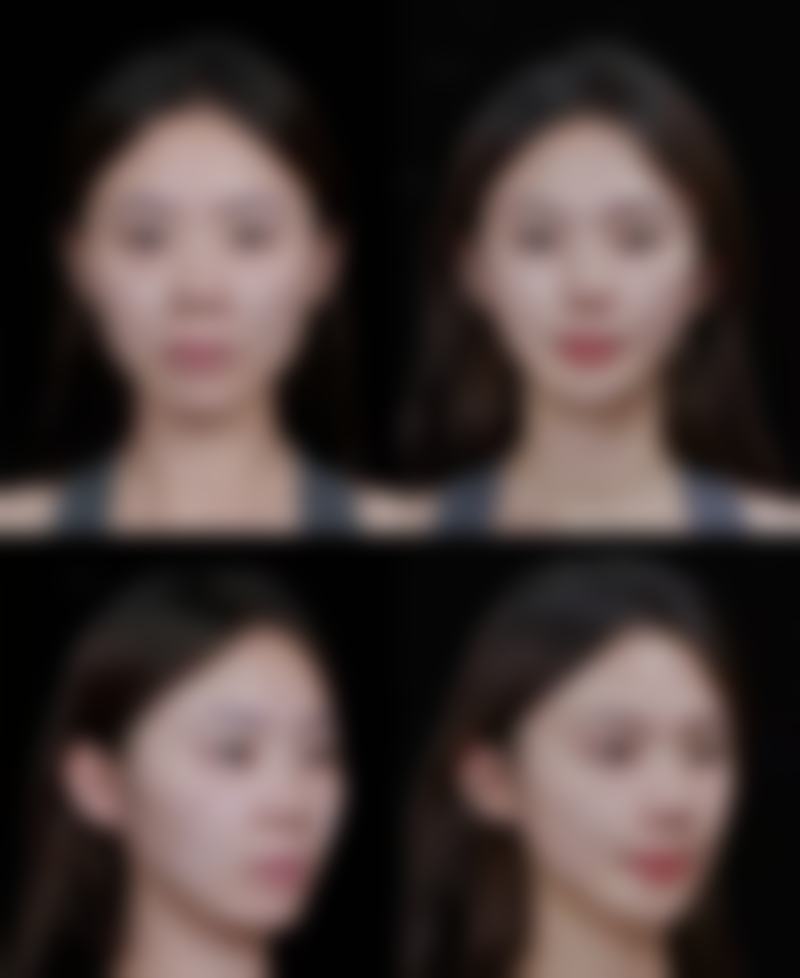 山东淄博栾术医疗美容门诊部（轻医美）价格表