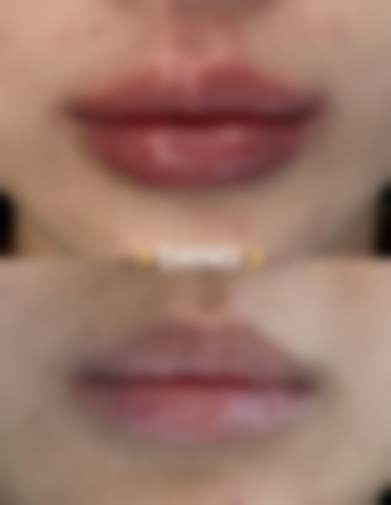 成都杜文医生技术特点