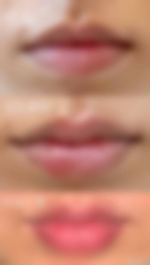 温州维纳斯医疗美容医院擅长项目：多样之美等你来