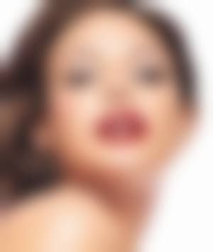 新昌县素美颜术整形医疗美容诊所真实实例