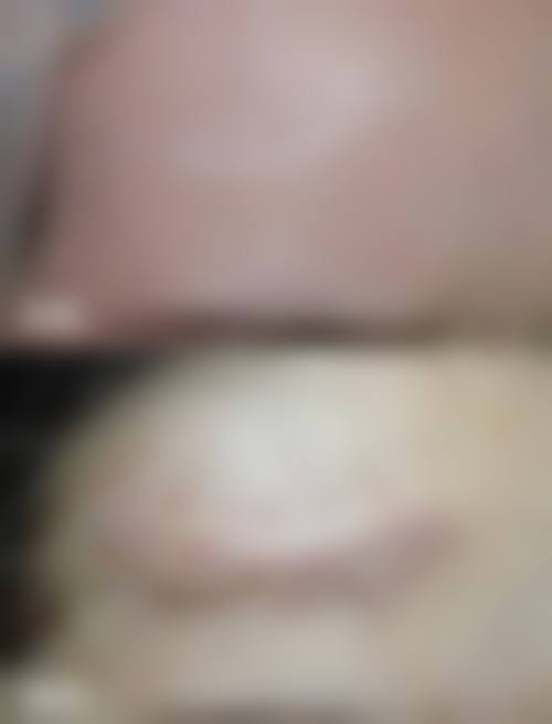 镇江丹徒区人民医院整形外科价格表：合理收费打造美丽