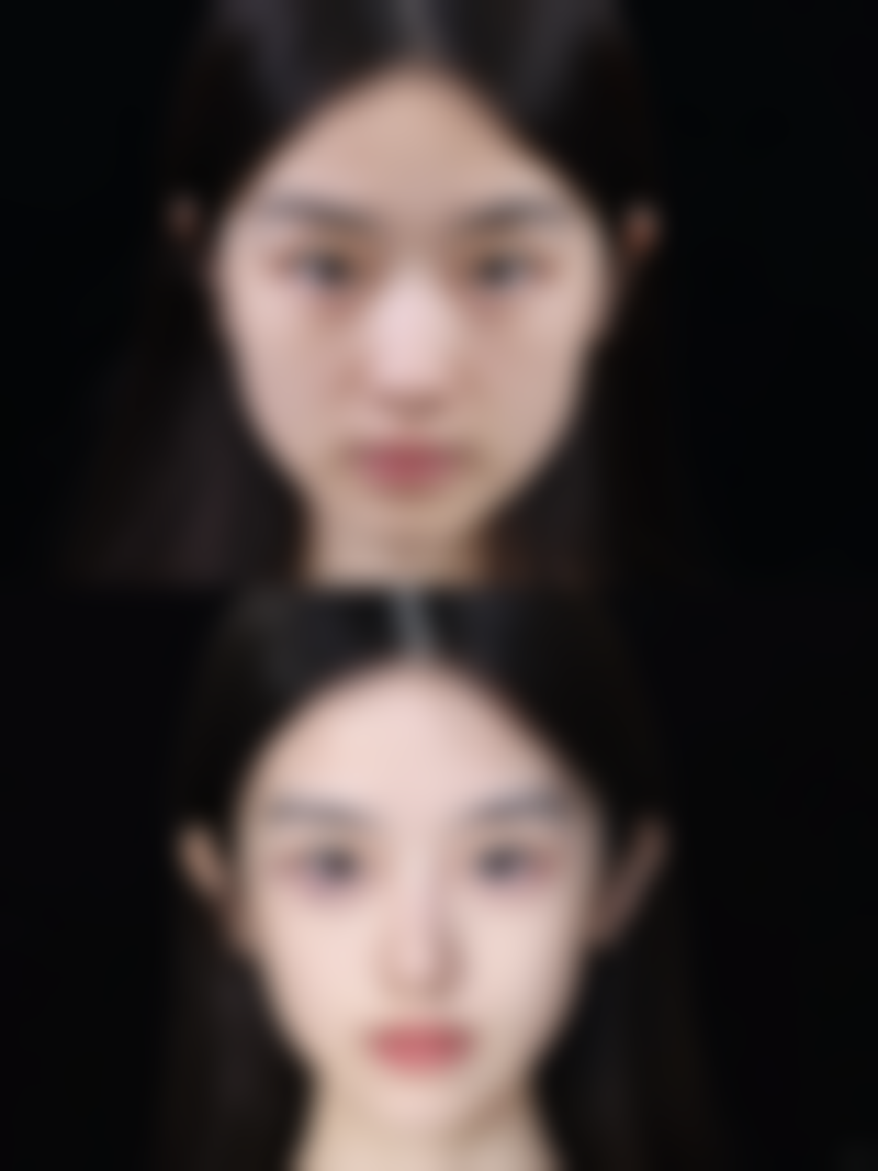 韦清洁医生擅长项目