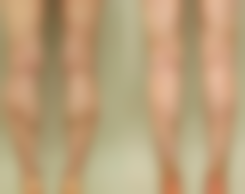 刘伟华医生口碑评价：求美者的一致好评