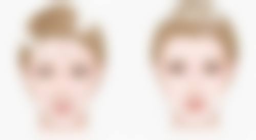 吴艾竞院长的真实实例