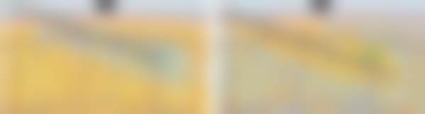 韩国丽婷Liting整形外科医院擅长项目:打造专属美丽