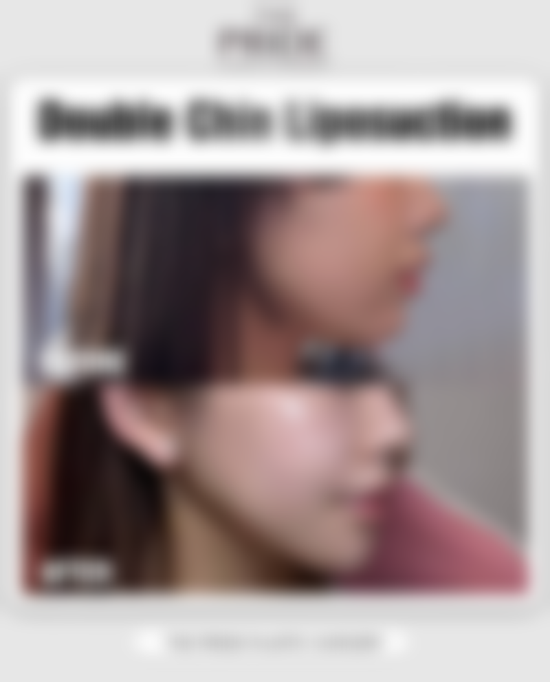 去眼袋贴膜值不值购买