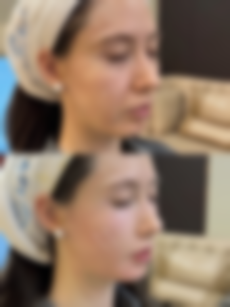 吴艾竞院长的擅长项目