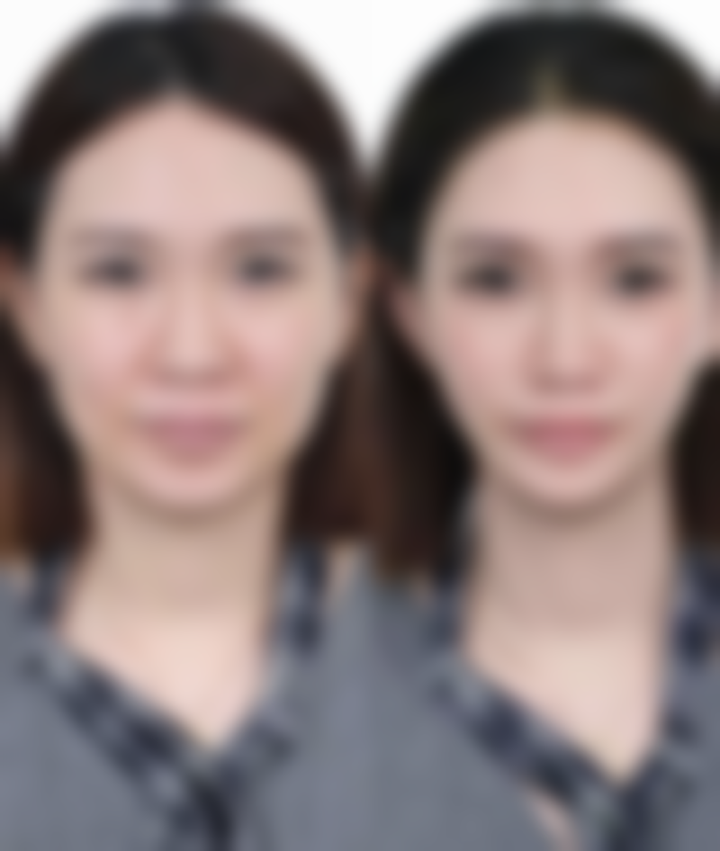 吴艾竞院长的看诊优势