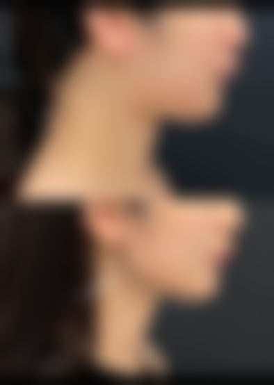 莱芜市人民医院整形美容科口碑怎么样：众多实例见证实力