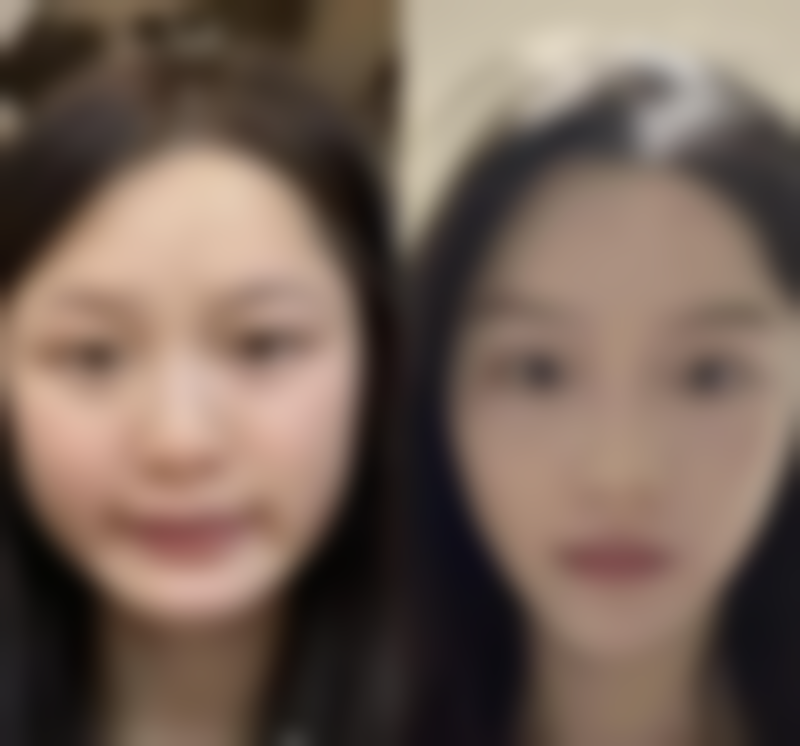 去眼袋贴膜适合哪些人群