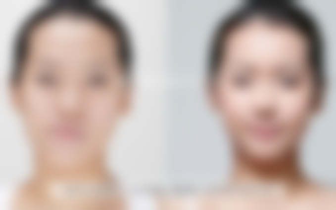 韩国REGEN丽珍整形外科医院擅长项目