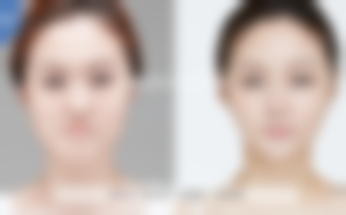 韩国REGEN丽珍整形外科医院仪器设备