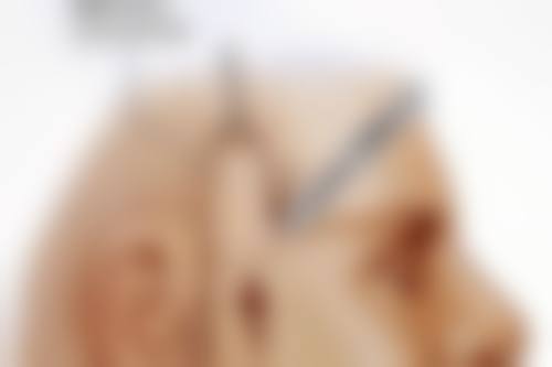 郭华峰医生怎么预约挂号