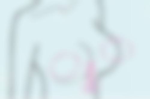 打瘦脸针后除了柚子还能吃什么水果