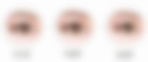 卫长荣医生擅长项目：烧伤整形的高能高手