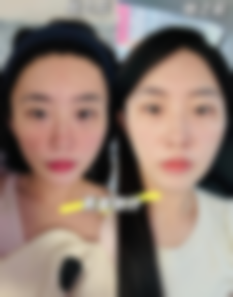 哈尔滨美涵美整形医院仪器设备：精良科技助力美丽