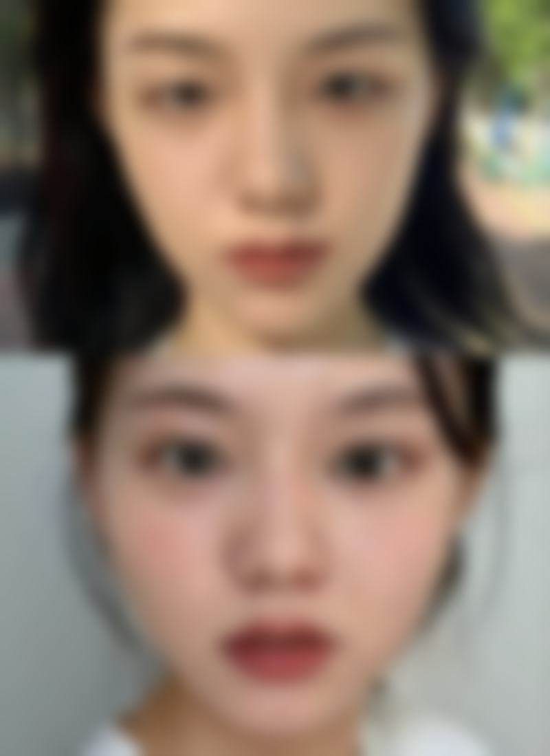 郑州明星医疗美容诊所价格表:合理价格享受高品质服务