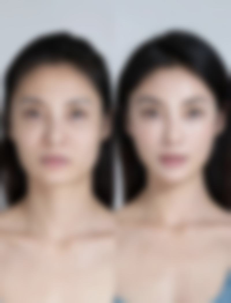 药物治疗切眼袋留下的疤痕适合吗