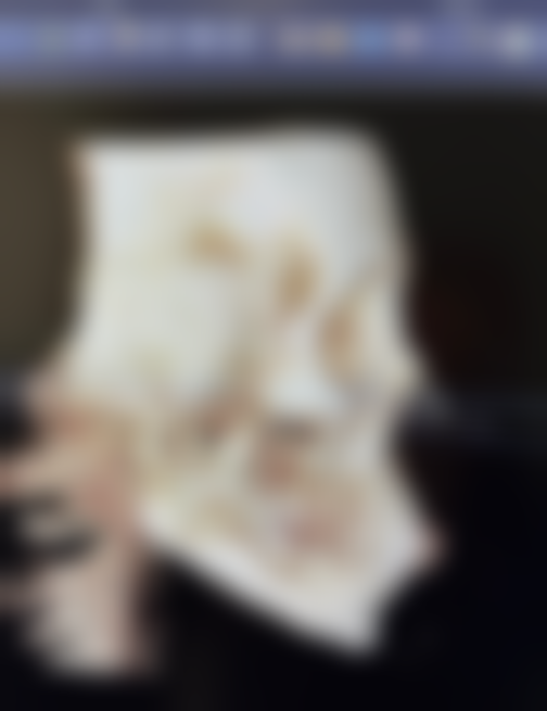 医美修复小孩面部摔伤疤痕有哪些注意事项