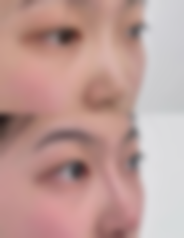 品川美容神户真实实例：见证美丽蜕变