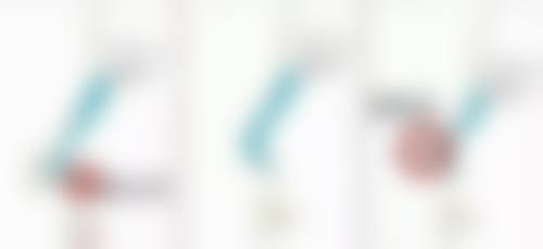 综合治疗去除疤痕凹陷成效能维持多久？