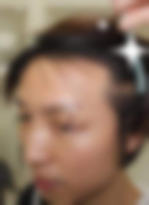 扬州圣兰医疗美容诊所仪器设备：精良科技，助力美丽升级