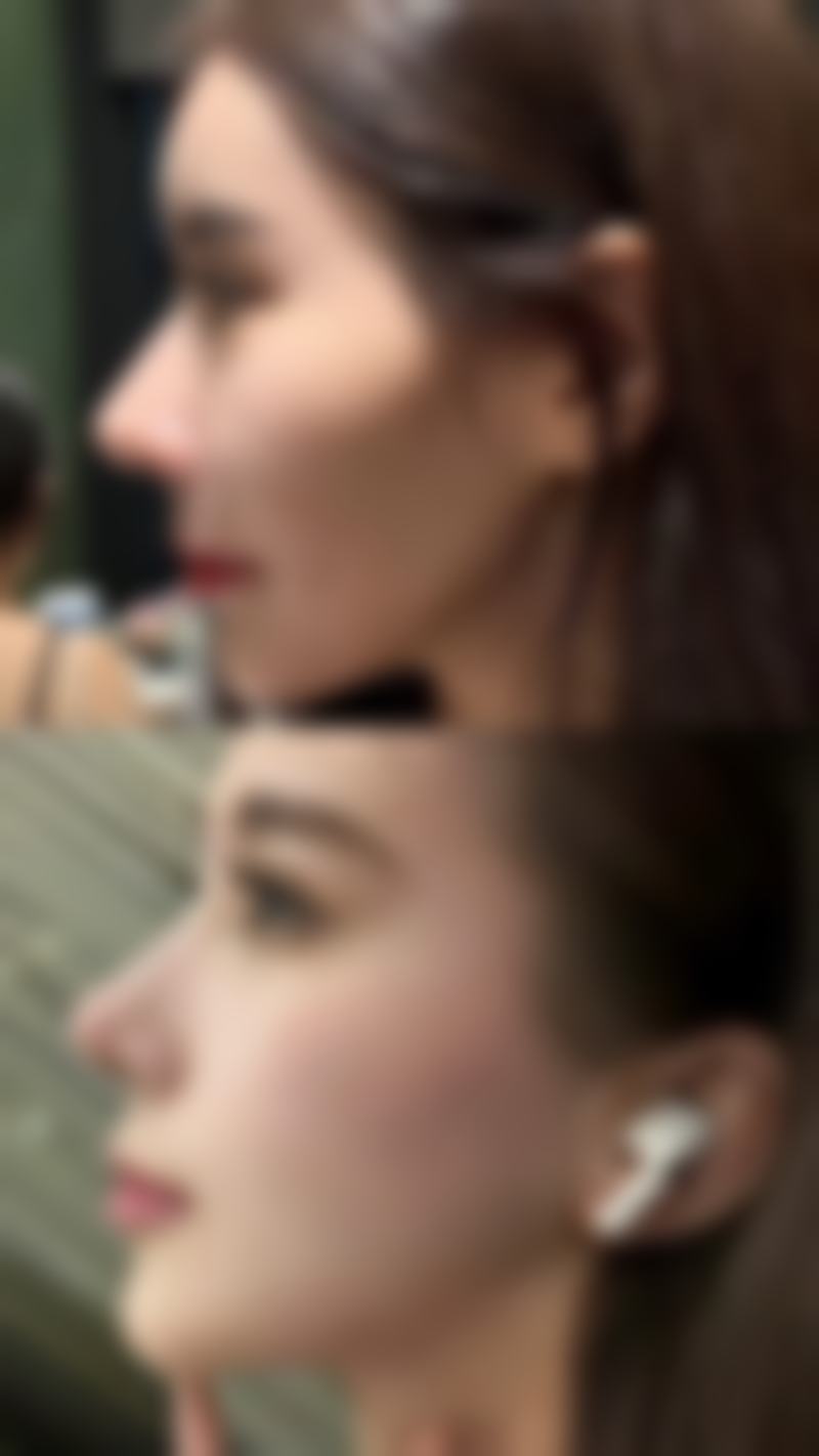 扬州圣兰医疗美容诊所价格表：合理收费，美丽无负担