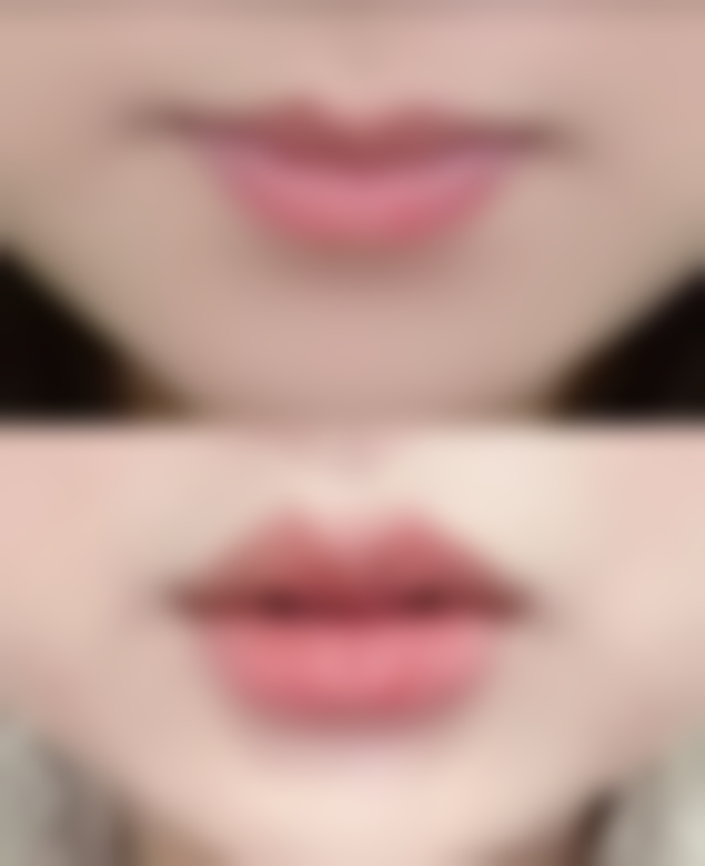 张升医生的技术特点