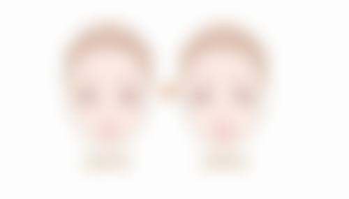 假体隆胸成效保持10 - 15年值不值