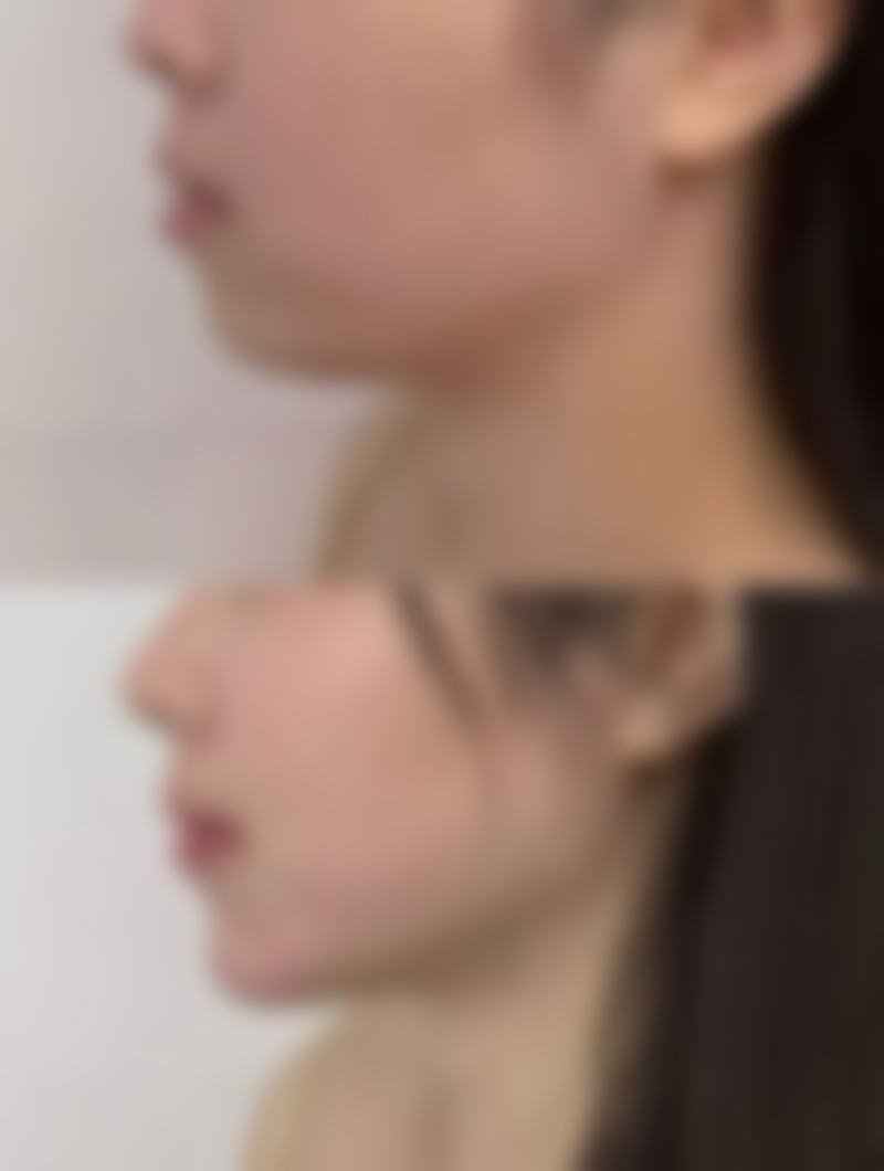 仇鑫钰医生技术特点：匠心独运的变得更美之道