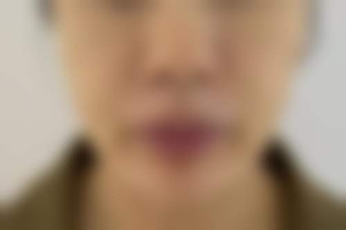 盐城大丰维多利亚医疗美容门诊部擅长项目