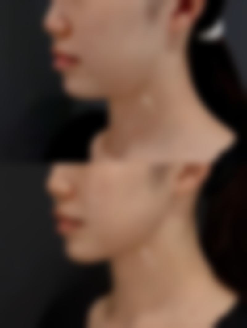 韩国BeyondMoon整形医院电话号码