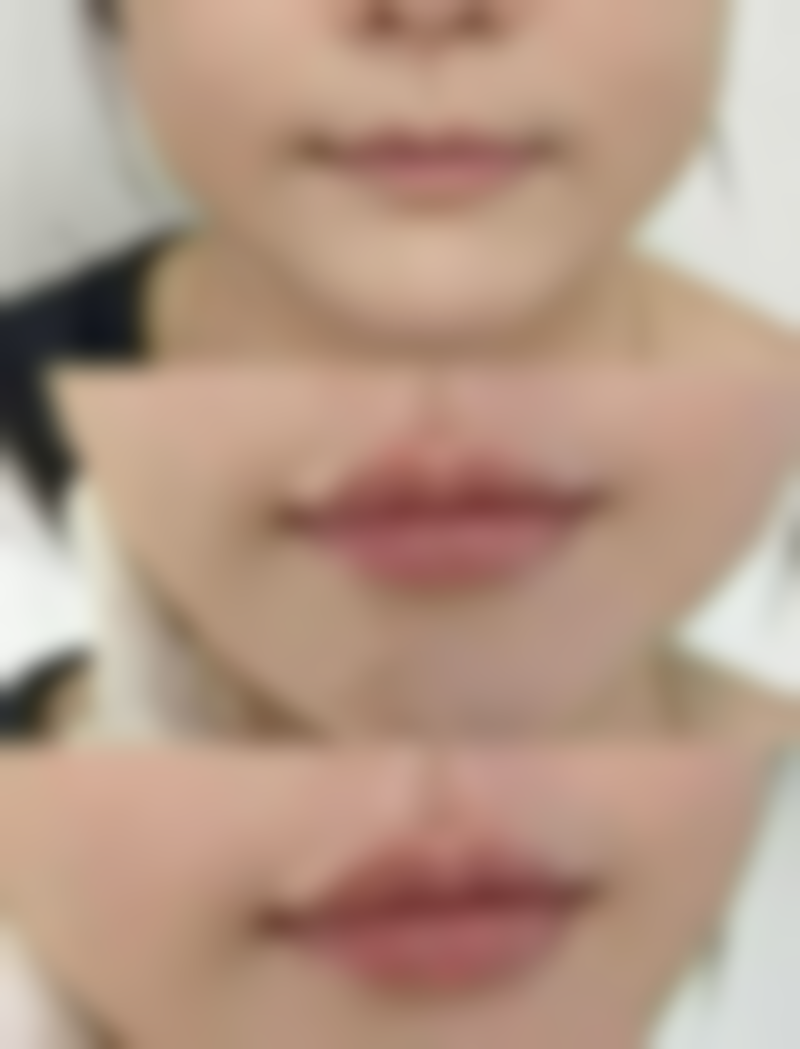 深圳罗湖博爱曙光医院预约挂号方式