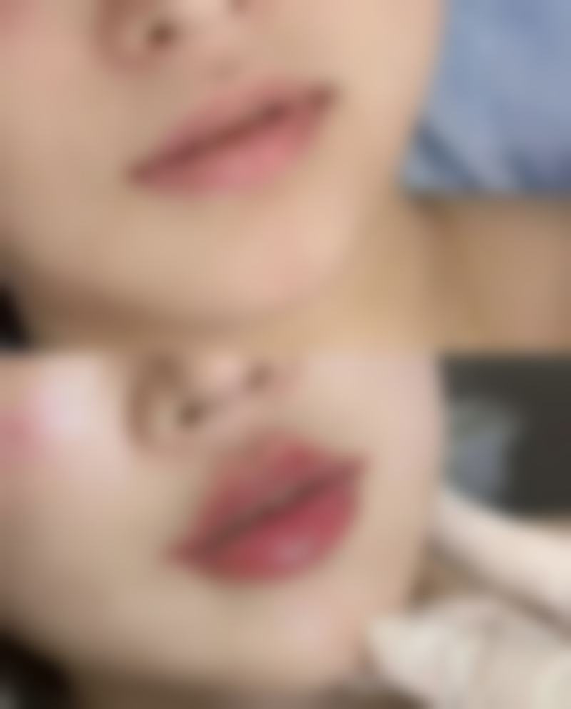 深圳罗湖博爱曙光医院价格表