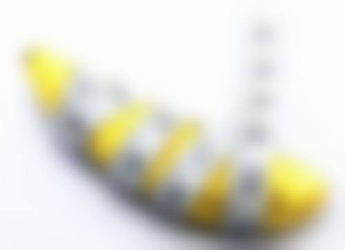 精品医美技术三阶段治疗法去除眼袋靠谱吗