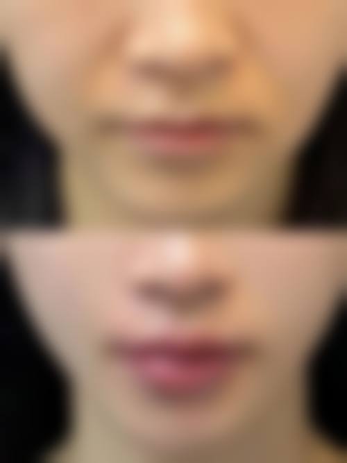 西宁美莱馨怡整形美容医院价格表