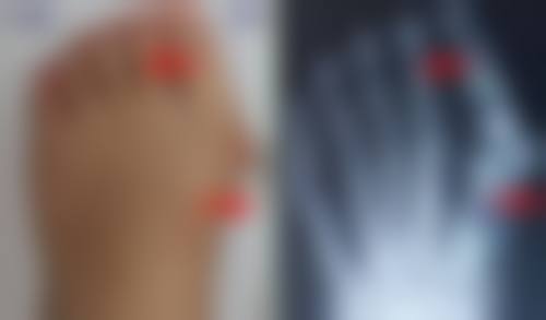 西宁美莱馨怡整形美容医院真实实例