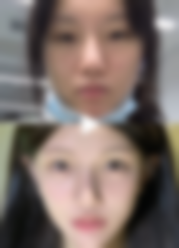 日本MAXFACS GINZA美容整形医院价格表