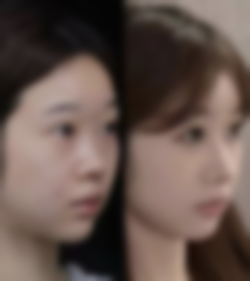 四川攀枝花市中医和西医结合医院真实实例